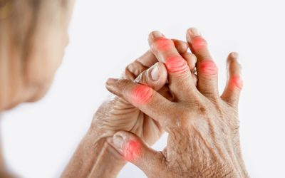 The Benefits of Tai Chi for People with Arthritis